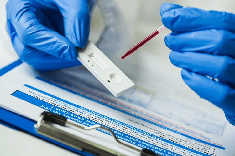 Serology